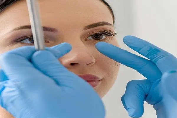 New Project (22) Key features of smart plastic surgery